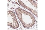 Immunohistochemical staining of human testis shows positivity in cells in seminiferous ducts.