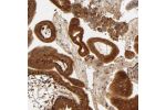 Immunohistochemical staining of human placenta show strong cytoplasmic positivity in trophoblastic cells.