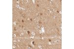 Immunohistochemical staining of human cerebral cortex shows strong cytoplasmic positivity in neuronal cells.