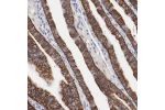 Immunohistochemical staining of human fallopian tube shows strong membranous positivity in glandular cells.