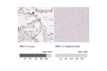 Immunohistochemistry analysis in human lung and cerebral cortex tissues using HPA004114 antibody. Corresponding MRC1 RNA-seq data are presented for the same tissues.