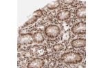 Immunohistochemical staining of human colon shows strong nuclear and moderate cytoplasmic positivity in glandular cells.
