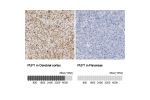 Immunohistochemistry analysis in human cerebral cortex and pancreas tissues using Anti-PLP1 antibody. Corresponding PLP1 RNA-seq data are presented for the same tissues.