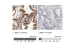 Immunohistochemistry analysis in human placenta and prostate tissues using Anti-LAMB1 antibody. Corresponding LAMB1 RNA-seq data are presented for the same tissues.