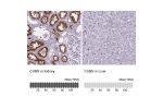 Immunohistochemistry analysis in human kidney and liver tissues using HPA004133 antibody. Corresponding CUBN RNA-seq data are presented for the same tissues.