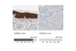 Immunohistochemistry analysis in human skin and liver tissues using Anti-AHNAK2 antibody. Corresponding AHNAK2 RNA-seq data are presented for the same tissues.