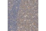 Immunohistochemical staining of human lymph node shows moderate cytoplasmic positivity in reaction center cells.