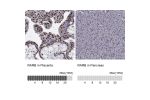 Immunohistochemistry analysis in human placenta and pancreas tissues using HPA004174 antibody. Corresponding RARB RNA-seq data are presented for the same tissues.