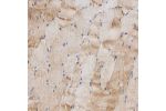 Immunohistochemical staining of human skeletal muscle shows moderate cytoplasmic positivity in myocytes.