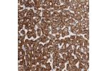 Immunohistochemical staining of human Liver shows strong granular cytoplasmic positivity in hepatocytes.