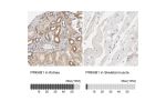 Immunohistochemistry analysis in human kidney and skeletal muscle tissues using HPA004247 antibody. Corresponding PRKAB1 RNA-seq data are presented for the same tissues.