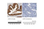 Immunohistochemistry analysis in human prostate and endometrium tissues using Anti-ACPP antibody. Corresponding ACPP RNA-seq data are presented for the same tissues.