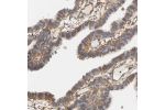Immunohistochemical staining of human fallopian tube shows strong cytoplasmic granular positivity in glandular cells.