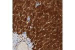 Immunohistochemical staining of human liver shows strong cytoplasmic positivity in hepatocytes.