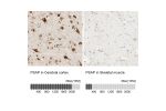 Immunohistochemistry analysis in human cerebral cortex and skeletal muscle tissues using HPA004426 antibody. Corresponding PSAP RNA-seq data are presented for the same tissues.