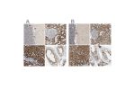 Immunohistochemical staining of human cerebellum, kidney, liver and testis using Anti-ACAT1 antibody HPA004428 (A) shows similar protein distribution across tissues to independent antibody HPA007569 (B).