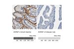 Immunohistochemistry analysis in human small intestine and fallopian tube tissues using HPA004625 antibody. Corresponding ANPEP RNA-seq data are presented for the same tissues.