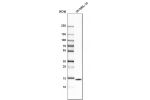 Western blot analysis in human cell line SK-MEL-30.