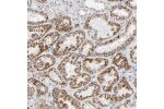 Immunohistochemical staining of human kidney shows strong cytoplasmic positivity in tubular cells.