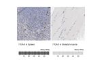 Immunohistochemistry analysis in human spleen and skeletal muscle tissues using HPA004723 antibody. Corresponding ITGAX RNA-seq data are presented for the same tissues.