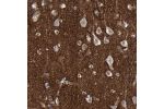 Immunohistochemical staining of human cerebral cortex shows strong positivity in neuropil.