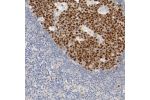 Immunohistochemical staining of human lymph node shows strong nuclear positivity in germinal center cells.