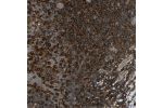 Immunohistochemical staining of human tonsil shows very strong cytoplasmic positivity in non-germinal center cells.