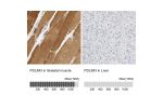 Immunohistochemistry analysis in human skeletal muscle and liver tissues using HPA004749 antibody. Corresponding PDLIM3 RNA-seq data are presented for the same tissues.