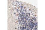Immunohistochemical staining of human cerebellum shows moderate cytoplasm granular positivity in Purkinje cells.
