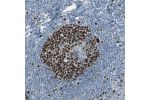 Immunohistochemical staining of human tonsil shows strong nuclear positivity in reaction center cells.