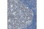 Immunohistochemical staining of human lymph node shows strong nuclear positivity in germinal center cells.