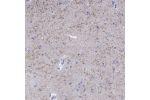 Immunohistochemical staining of human caudate nucleus shows moderate positivity in synapses and neuronal projections.