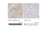 Immunohistochemistry analysis in human skeletal muscle and liver tissues using HPA004807 antibody. Corresponding MEF2D RNA-seq data are presented for the same tissues.