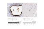 Immunohistochemistry analysis in human epididymis and skeletal muscle tissues using HPA004810 antibody. Corresponding IFITM1 RNA-seq data are presented for the same tissues.