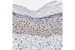 Immunohistochemical staining of human skin shows moderate to strong nuclear positivity in squamous epithelial cells.
