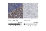 Immunohistochemistry analysis in human lymph node and liver tissues using Anti-MCM6 antibody. Corresponding MCM6 RNA-seq data are presented for the same tissues.