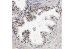 Immunohistochemical staining of human urinary bladder shows strong nuclear positivity in urothelial cells.