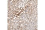 Immunohistochemical staining of human hippocampus shows distinct positivity in neuropil.