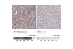 Immunohistochemistry analysis in human endometrium and liver tissues using HPA004835 antibody. Corresponding ZYX RNA-seq data are presented for the same tissues.