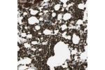 Immunohistochemical staining of human bone marrow shows strong positivity in erythrocytes and subsets of hematopoietic cells.