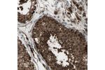Immunohistochemical staining of human testis shows strong positivity in cells in seminiferous ducts.