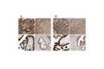 Immunohistochemical staining of human gastrointestinal, liver, placenta and prostate using Anti-GALT antibody HPA004868 (A) shows similar protein distribution across tissues to independent antibody HPA005729 (B).