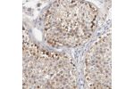 Immunohistochemical staining of human testis shows moderate cytoplasmic positivity in cells in seminiferous ducts.