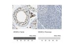 Immunohistochemistry analysis in human testis and pancreas tissues using HPA004873 antibody. Corresponding MCM4 RNA-seq data are presented for the same tissues.