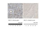 Immunohistochemistry analysis in human salivary gland and skeletal muscle tissues using HPA004880 antibody. Corresponding MELTF RNA-seq data are presented for the same tissues.