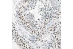 Immunohistochemical staining of human testis shows moderate nuclear positivity in cells in seminiferous ducts.
