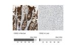Immunohistochemistry analysis in human rectum and liver tissues using HPA004896 antibody. Corresponding DSG2 RNA-seq data are presented for the same tissues.