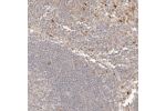 Immunohistochemical staining of human Lymph node shows moderate cytoplasmic positivity in subset of non-germinal center cells.