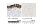 Immunohistochemistry analysis in human urinary bladder and cerebral cortex tissues using HPA004919 antibody. Corresponding HPGD RNA-seq data are presented for the same tissues.