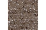 Immunohistochemical staining of human testis shows moderate cytoplasmic positivity in Leydig cells.